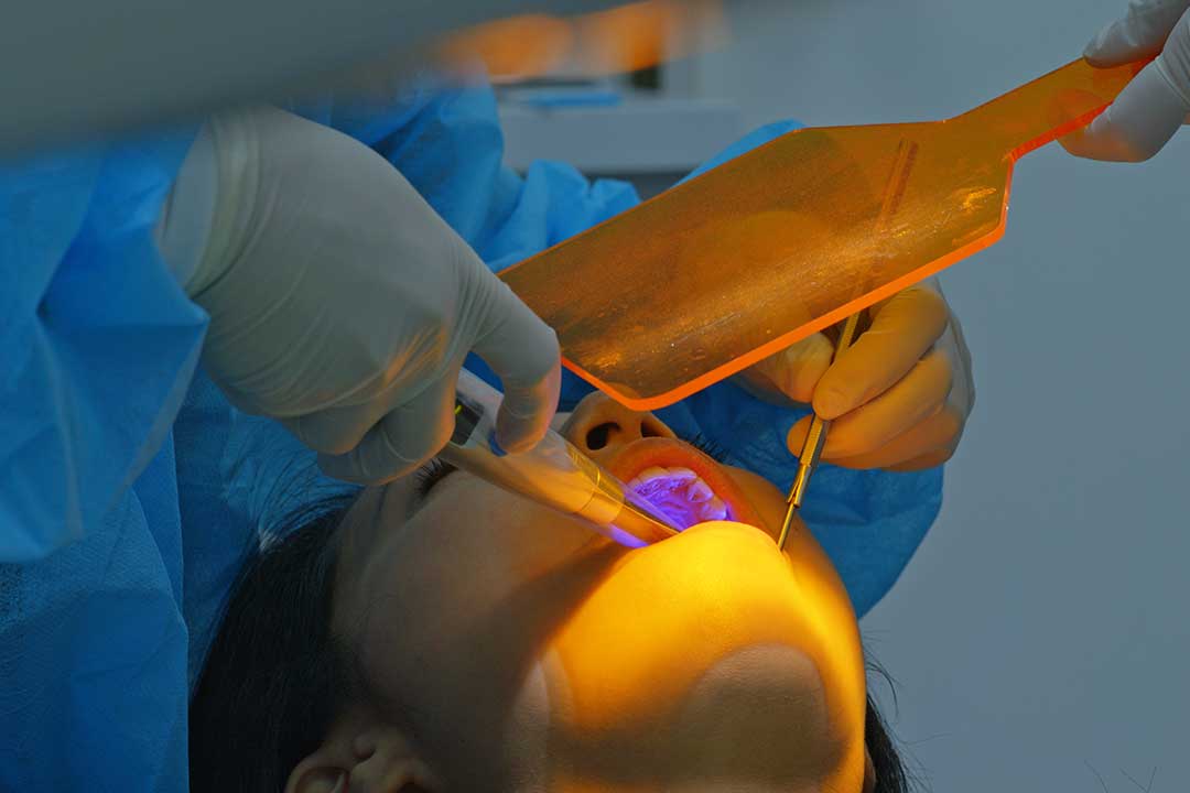 Laser Dentistry: Advantages in Modern Dental Care