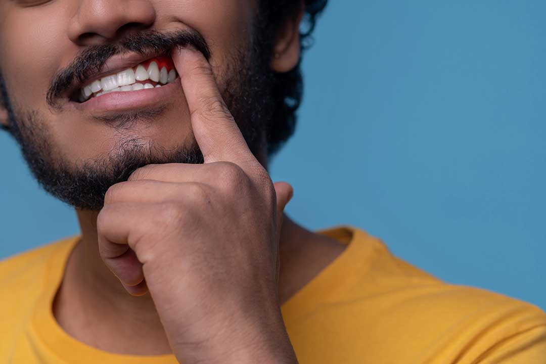 Silent Threat to Your Smile: Unmasking the Signs of Gum Disease